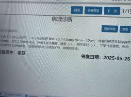 KRASQ61H突变，1A2期，后续治疗选择